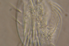 F.Erra Euplotes bisulcatus (DIC)