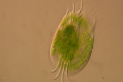 F.Erra Euplotes daidaleos (DIC)