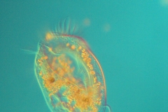 F.Erra Euplotes eurystomus (DIC)1