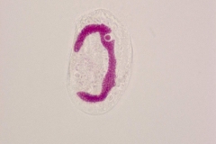 F.Erra Euplotes sp. (Impregnazione argentica)1