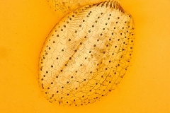 F.Erra Euplotes sp. (Impregnazione argentica)2