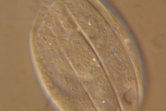 F.Erra Euplotes trisulcatus (DIC)