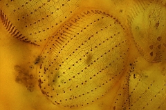 F.Erra Euplotes woodruffi (Impregnazione argentica)