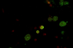 Toxoplasma 1