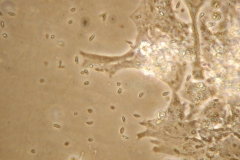 Toxoplasma2