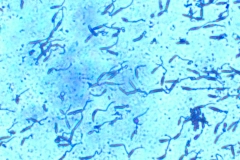 leishmanie 1